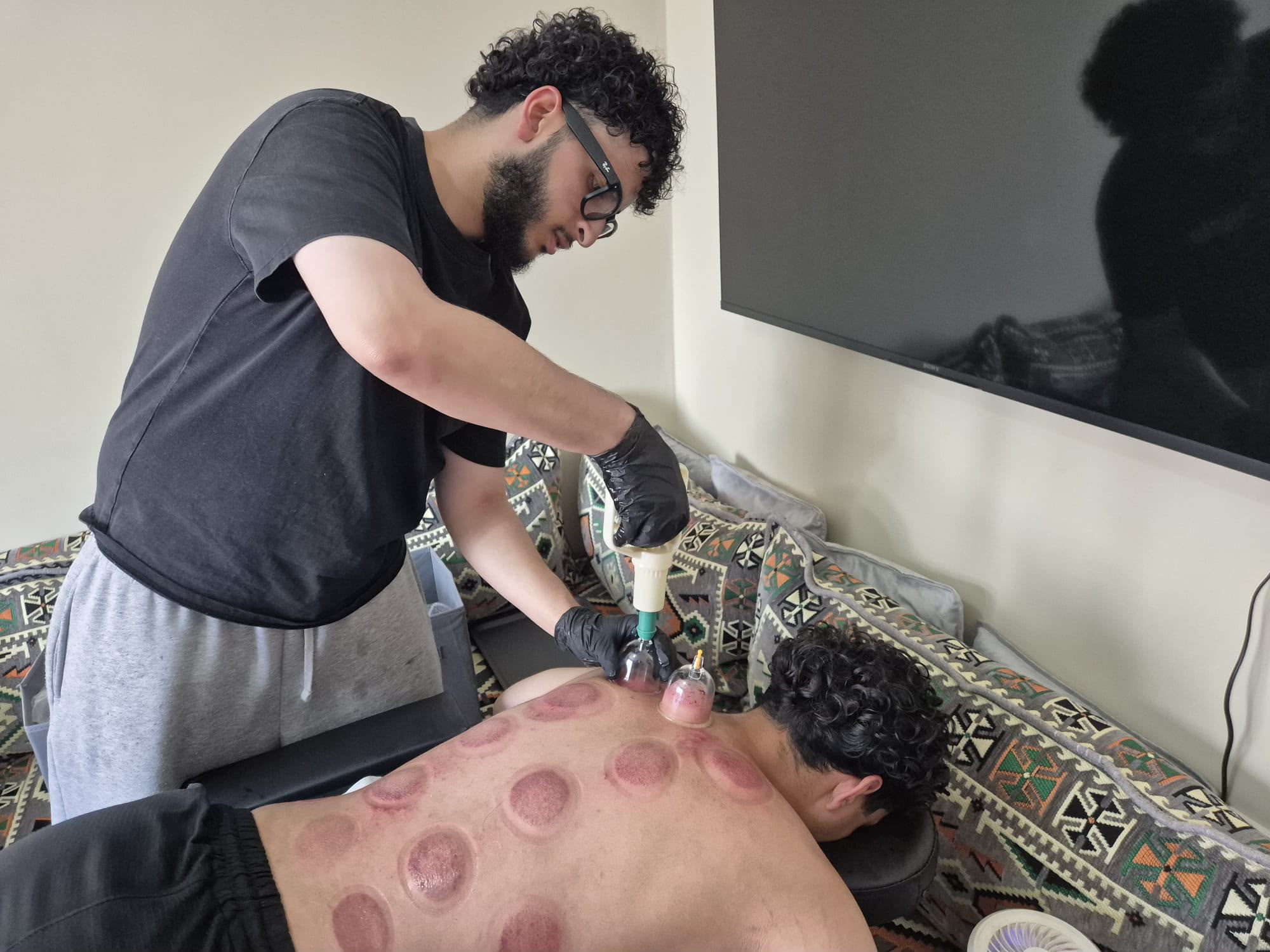 Wet cupping treatment procedure